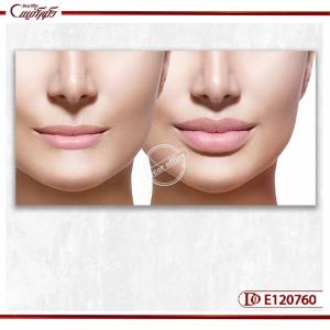 تابلو دکوراتیو فیلر لب- تفاوت لب طبیعی و لب برجسته E120760