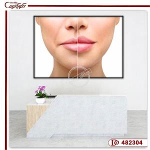 تابلو کلینیک تزریق ژل و بوتاکس R482304