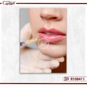 تابلو تزریق ژل لب-جلوه طبیعی و لبخند جذاب R108411