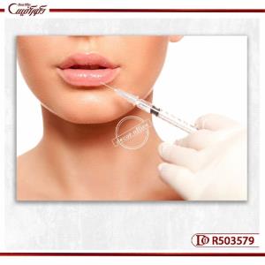 تابلو دکوری تزریق ژل لب R503579